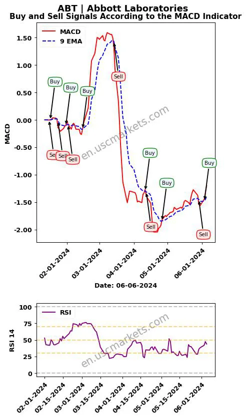 ABT buy or sell review Abbott Laboratories MACD chart analysis ABT price