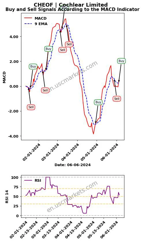 CHEOF buy or sell review Cochlear Limited MACD chart analysis CHEOF price