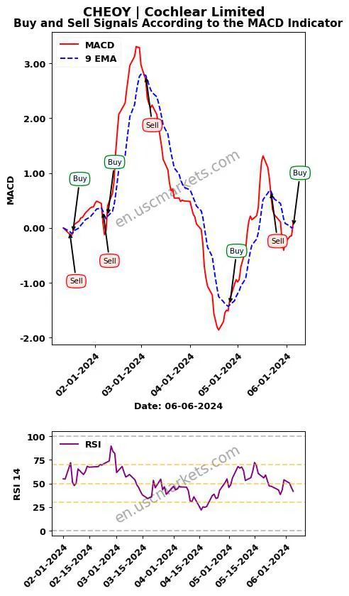 CHEOY buy or sell review Cochlear Limited MACD chart analysis CHEOY price