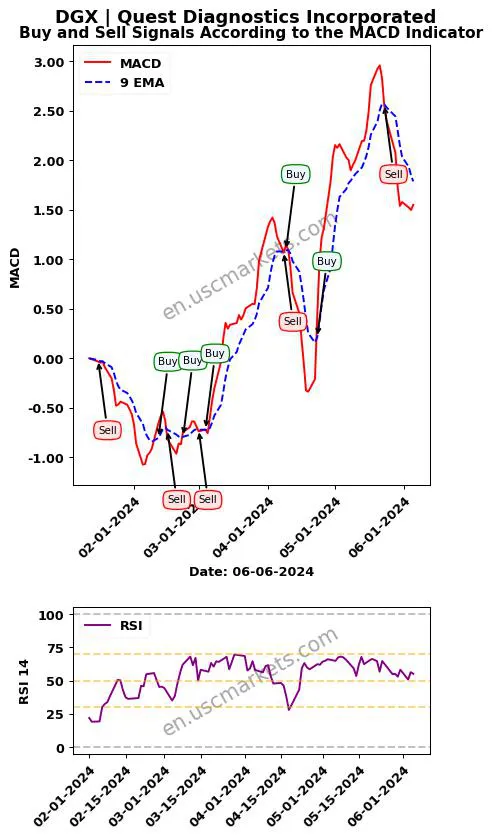 DGX buy or sell review Quest Diagnostics Incorporated MACD chart analysis DGX price