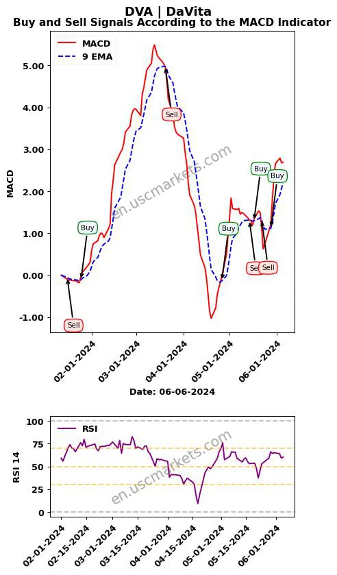 DVA buy or sell review DaVita Inc. MACD chart analysis DVA price