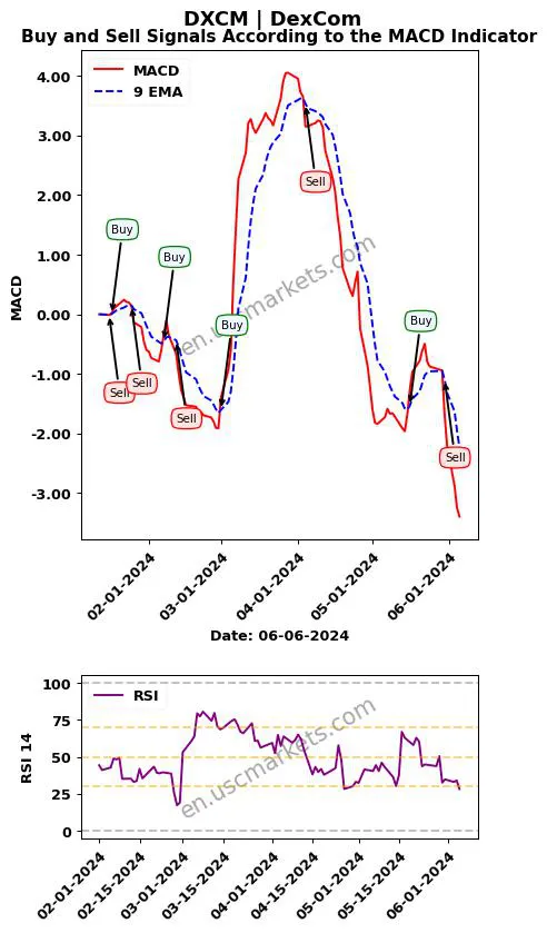 DXCM buy or sell review DexCom MACD chart analysis DXCM price