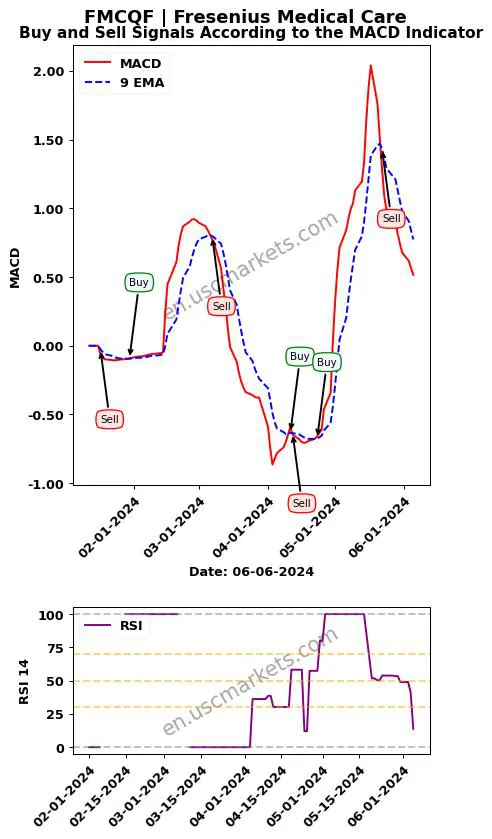 FMCQF buy or sell review Fresenius Medical Care MACD chart analysis FMCQF price