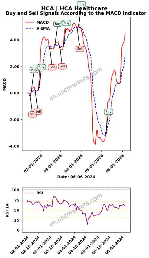 HCA buy or sell review HCA Healthcare MACD chart analysis HCA price