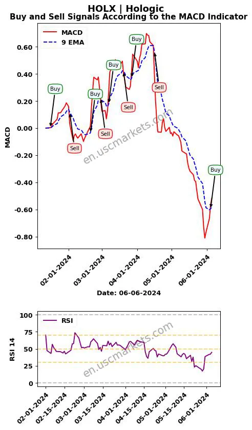 HOLX buy or sell review Hologic MACD chart analysis HOLX price