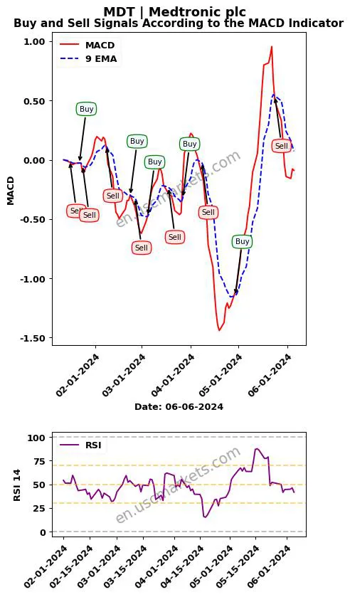 MDT buy or sell review Medtronic plc MACD chart analysis MDT price