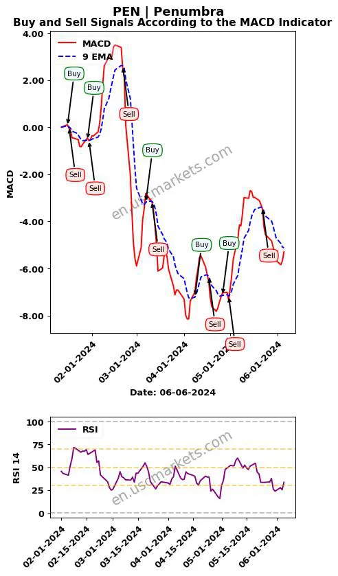 PEN buy or sell review Penumbra MACD chart analysis PEN price