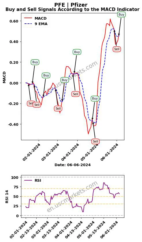 PFE buy or sell review Pfizer Inc. MACD chart analysis PFE price