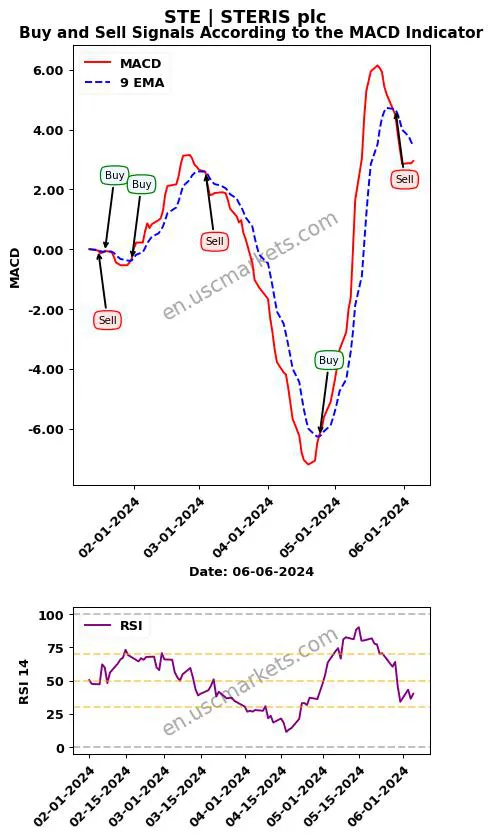 STE buy or sell review STERIS plc MACD chart analysis STE price