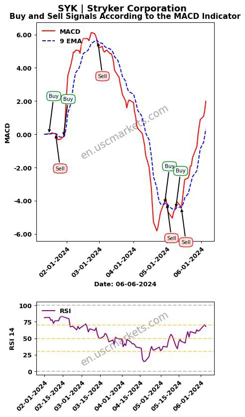 SYK buy or sell review Stryker Corporation MACD chart analysis SYK price