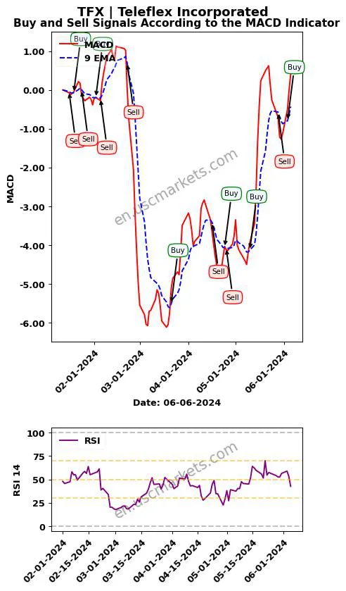 TFX buy or sell review Teleflex Incorporated MACD chart analysis TFX price